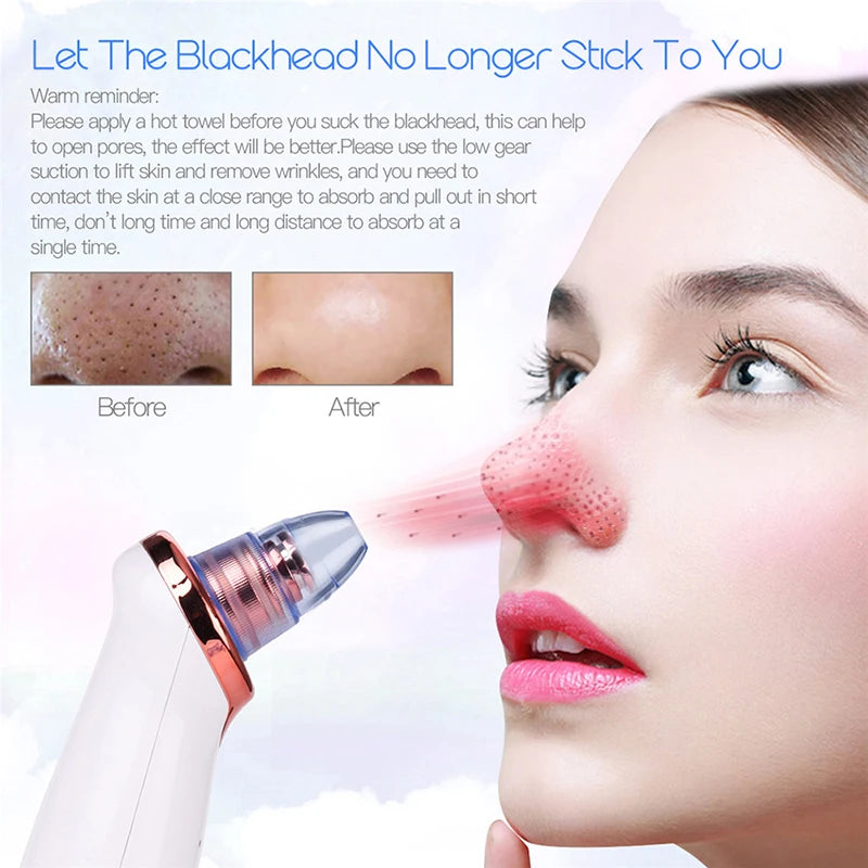 LumiVac Electric Vacuum Facial Blackhead Acne Remover